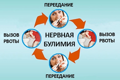 Лечение булимии в Дубовке